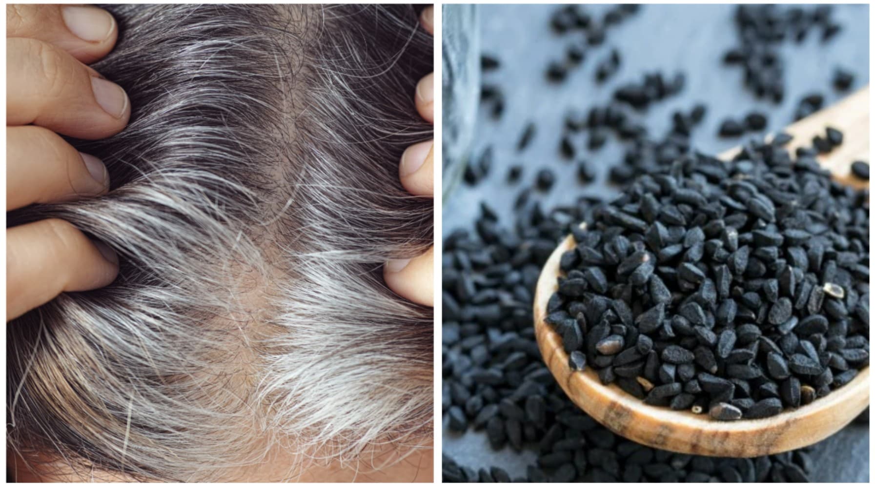 Kalonji for White Hair: सफेद बालों से छुटकारा पाएं: कलौंजी के 3 नेचुरल नुस्खे, बाल होंगे काले और चमकदार