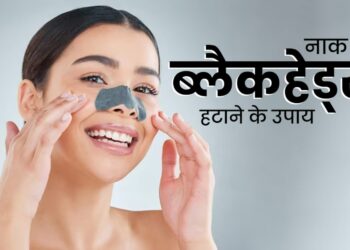 Blackheads Kaise Hataye: ब्लैकहेड्स को जड़ से खत्म करें! इन 5 घरेलू नुस्खों से पाएं साफ और चमकदार त्वचा