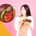 Health Tips: इन चीज़ों से बन सकती है पित्ताशय में पथरी, अभी से रखें खानपान का ध्यान!